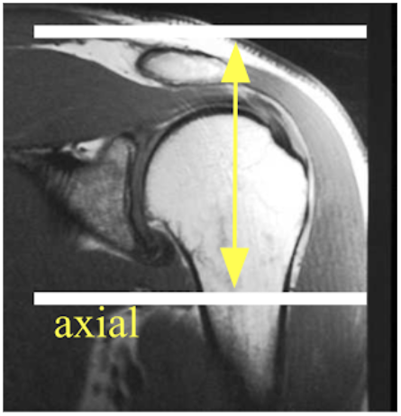 shoulder axial